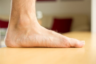 Running con pies planos: las lesiones más comunes y cómo prevenirlas